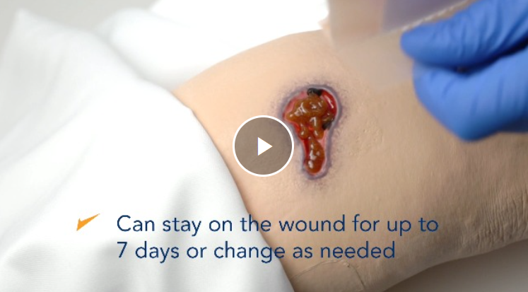 Medical-grade Manuka honey helps in speedy wound healing.